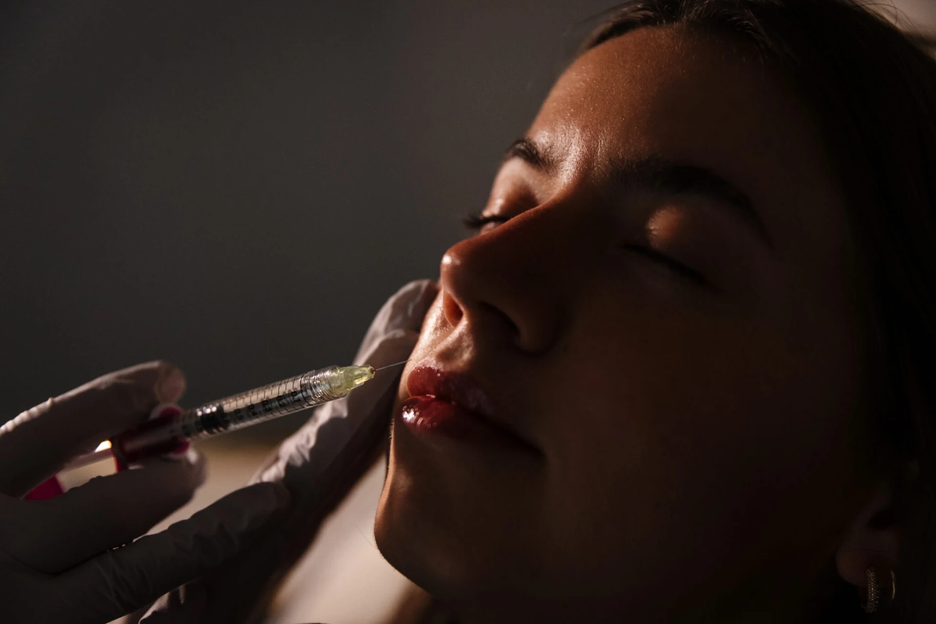 Close-up of a client's lips during filler treatment at Lemonade Aesthetics